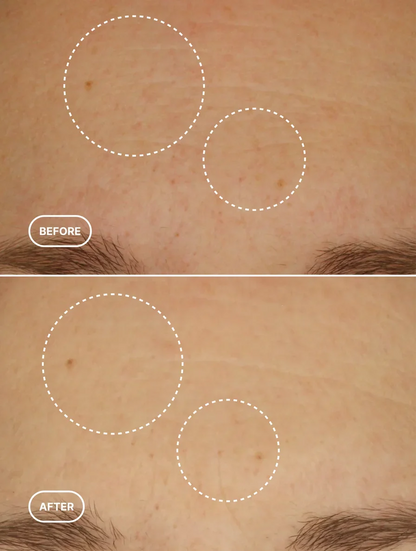 JT FORMULA Retinol Alternative Serum — product view 5